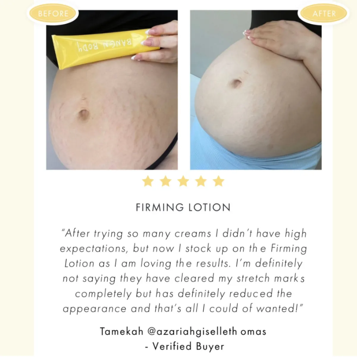 Limited Edition Mummy Bump Bundle